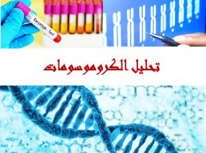 Read more about the article ماذا تعرف عن تحليل  الكروموسومات؟