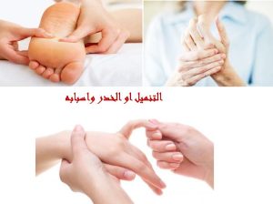 Read more about the article التنميل او الخدر واسبابه