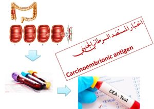 Read more about the article اختبار المستضد السرطاني الجنيني  Carcinoembrionic antigen