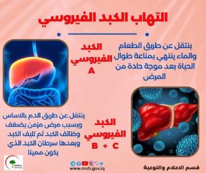 Read more about the article ماهي أعراض التهاب الكبد الفيروسي